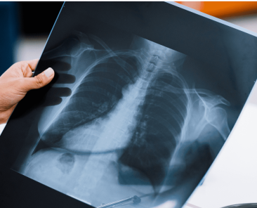 error diagnóstico de un cáncer
